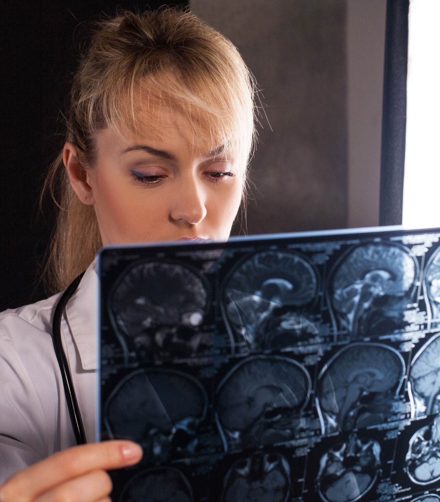 Washington Brain Injury Lawyer