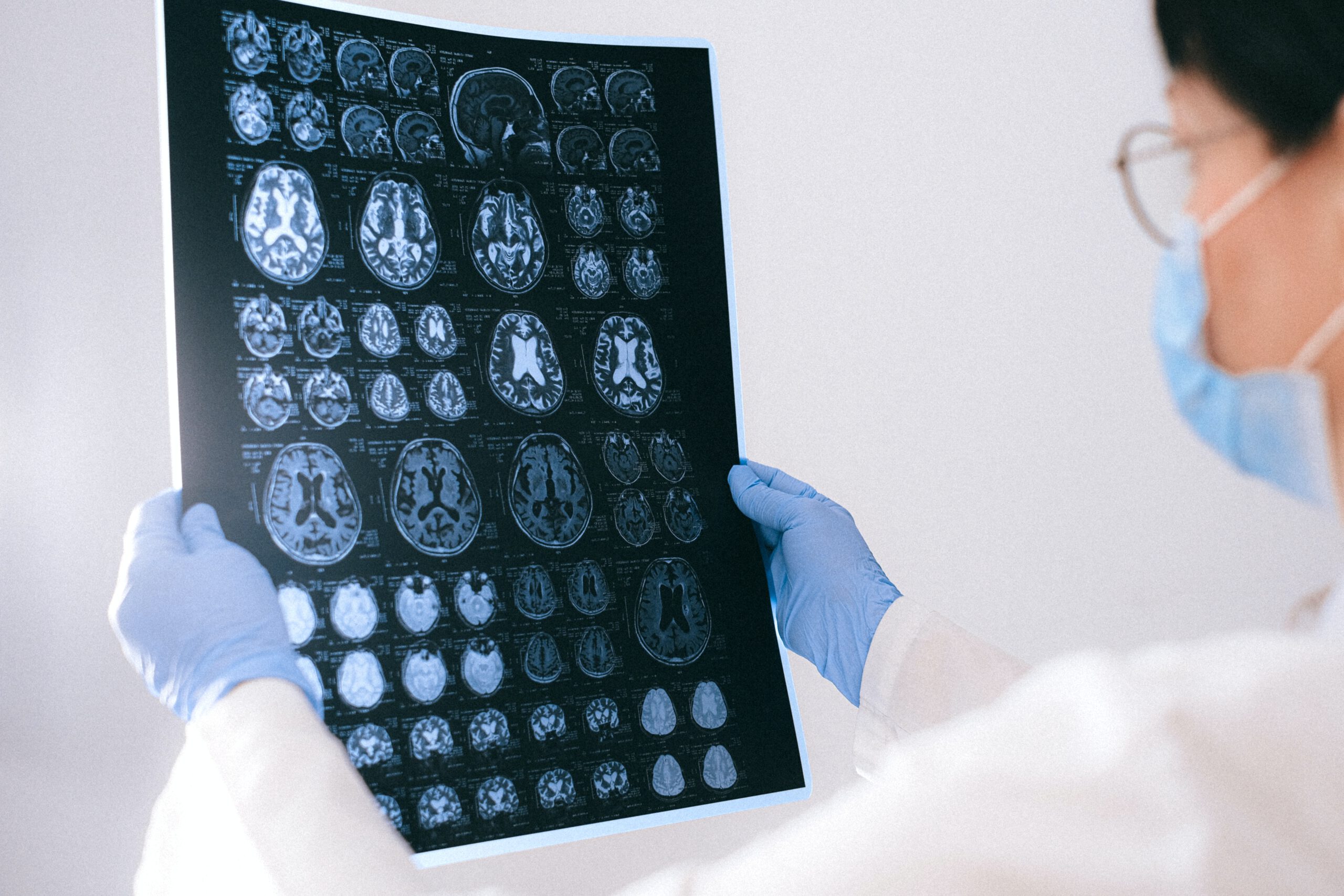 doctor brain injury
