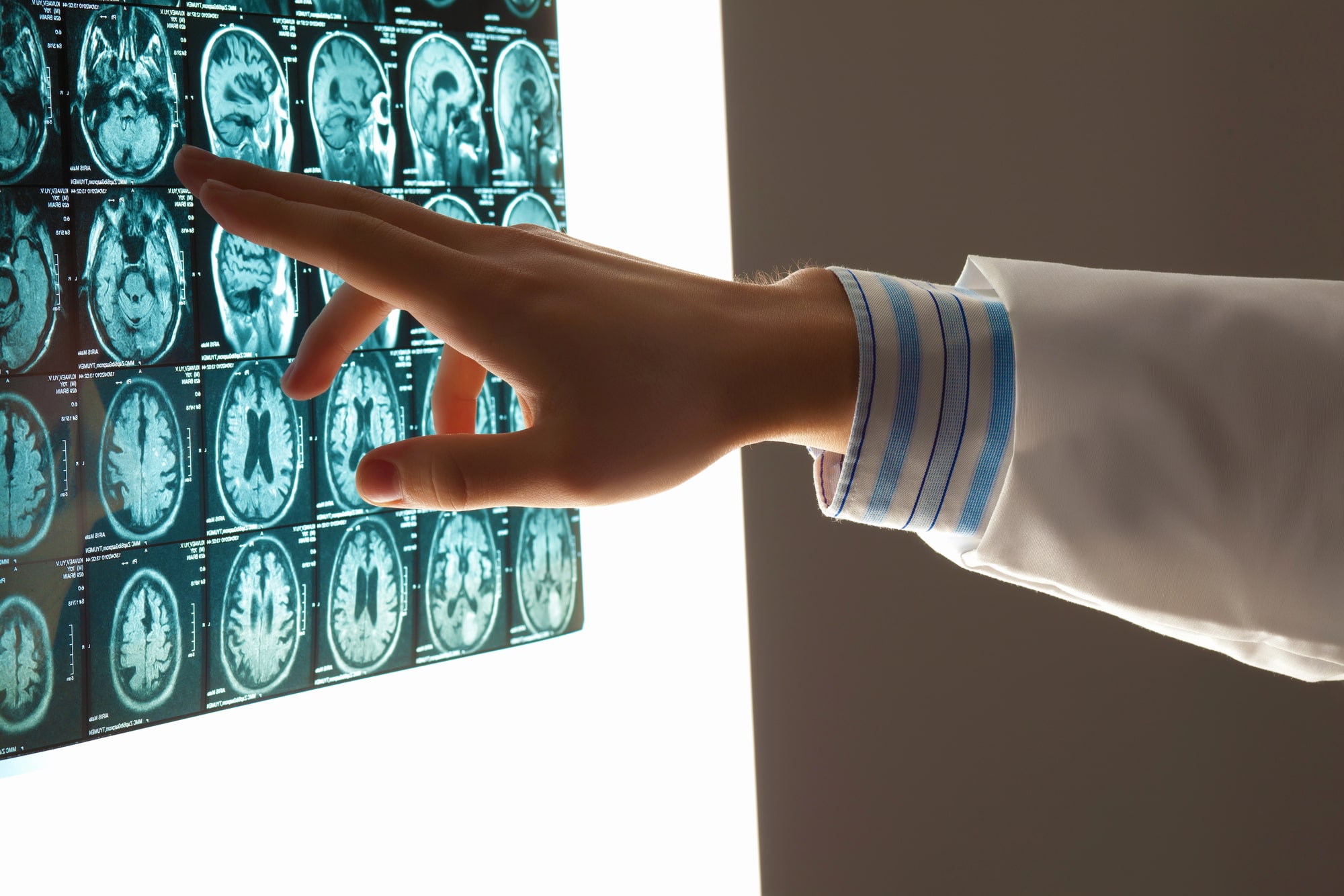 brain injury lawyer in Sandy, UT